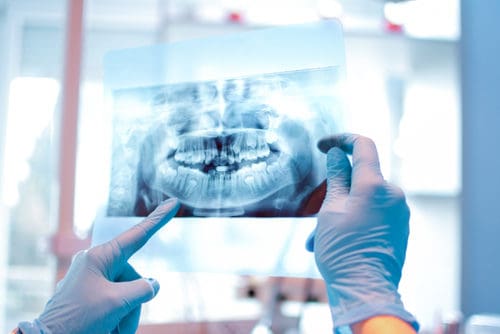 PG Dental Radiography